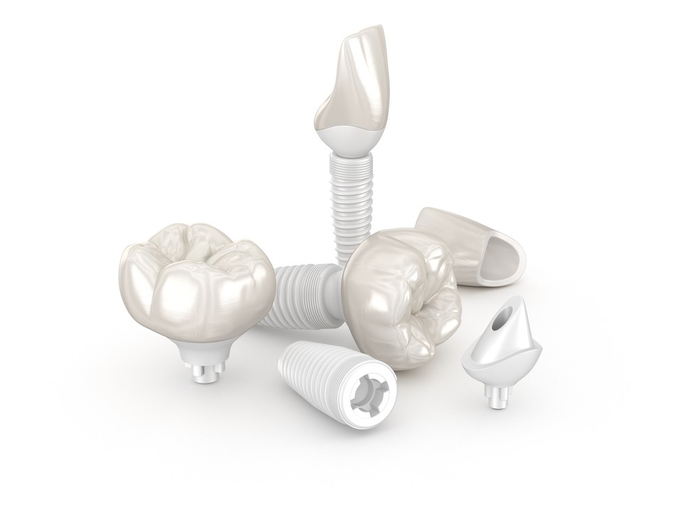 implant dentar ceramic