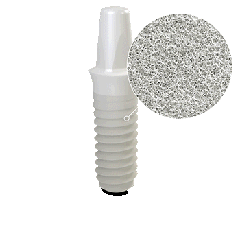 implant ceramic